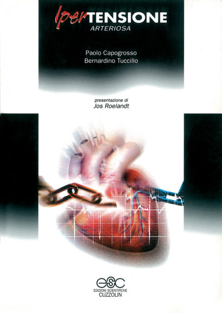 Ipertensione arteriosa