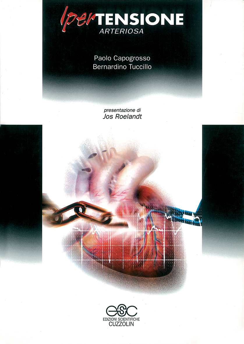 Ipertensione arteriosa