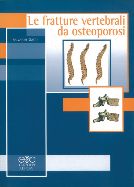 Le fratture vertebrali da osteoporosi