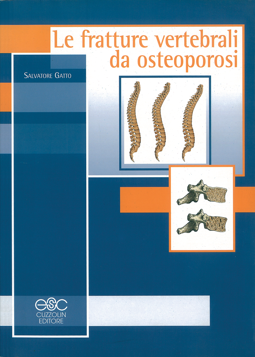 Le fratture vertebrali da osteoporosi