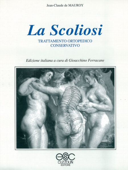 La scoliosi - Trattamento ortopedico conservativo